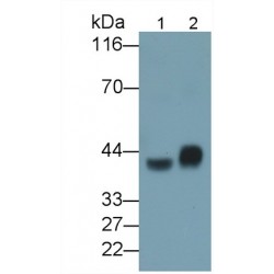 Asialoglycoprotein Receptor 1 (ASGR1) Antibody