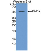 Western blot analysis of the recombinant protein.