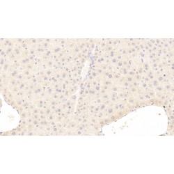 Carnitine Acetyltransferase (CRAT) Antibody