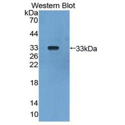 Glomulin (GLMN) Antibody