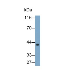 Haptoglobin Precursor / Zonulin (HP) Antibody