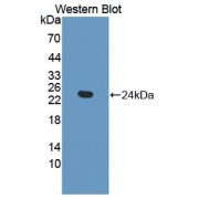 Western blot analysis of the recombinant protein.