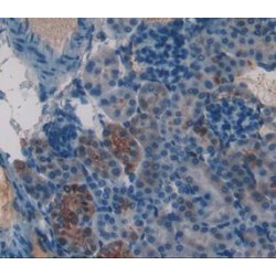 Frataxin (FXN) Antibody
