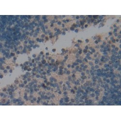 Proliferation Marker Protein Ki-67 (MKI67) Antibody