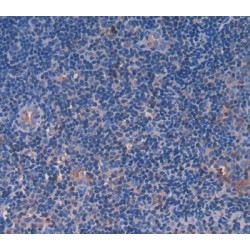 Proliferation Marker Protein Ki-67 (MKI67) Antibody