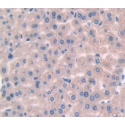 Interleukin-1 Beta (IL1B) Antibody