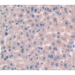 Interleukin 1 Beta (IL1b) Antibody