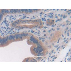 Glypican 3 (GPC3) Antibody