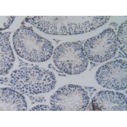 Nucleoporin 85 kDa (NUP85) Antibody