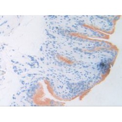 Activating Transcription Factor 6 (ATF6) Antibody