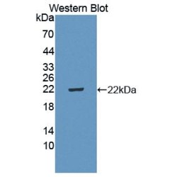 Interleukin 5 Receptor alpha (IL5RA) Antibody