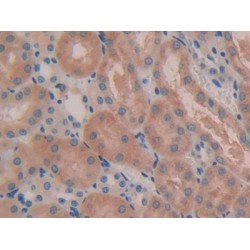 Interleukin 5 Receptor alpha (IL5RA) Antibody