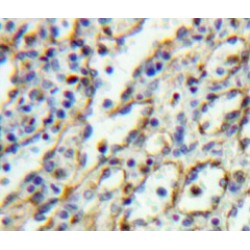 Interleukin 5 Receptor alpha (IL5RA) Antibody