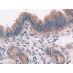 Protein Tyrosine Phosphatase Receptor Type J (PTPRJ) Antibody