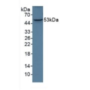 Western blot analysis of Human A375 Cells.