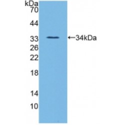 Angiopoietin-Related Protein 3 (ANGPTL3) Antibody