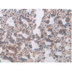 Angiopoietin-Related Protein 3 (ANGPTL3) Antibody