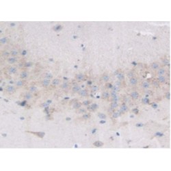 Angiopoietin-Related Protein 3 (ANGPTL3) Antibody
