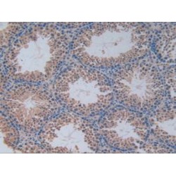 Phosphofructokinase, Platelet (PFKP) Antibody