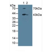 abx129768