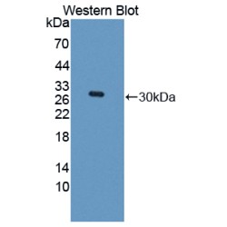 Rho-Associated Protein Kinase 1 (ROCK1) Antibody