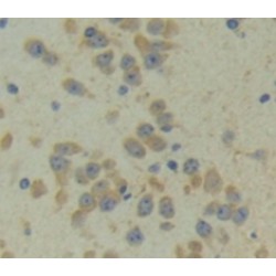 Cbp/p300 Interacting Transactivator, With Glu/Asp Rich Carboxy Terminal Domain 1 (CITED1) Antibody