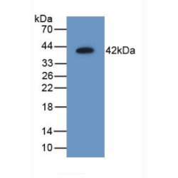 Aminoacyl tRNA Synthetase Complex Interacting Multifunctional Protein 1 (AIMP1) Antibody