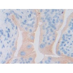 Glycoprotein 130 (gp130) Antibody