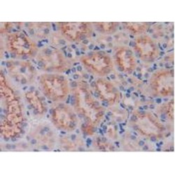 Cystatin C (CST3) Antibody