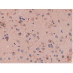 Cystatin C (CST3) Antibody
