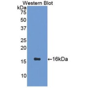Western blot analysis of the recombinant protein.