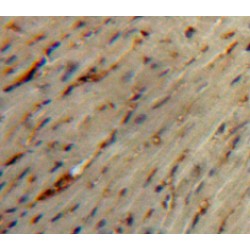 Secretin (SCT) Antibody