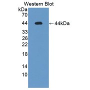 Western blot analysis of recombinant Mouse IL12Rb1.