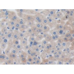 Interleukin 12 Receptor Beta 1 (IL12Rb1) Antibody