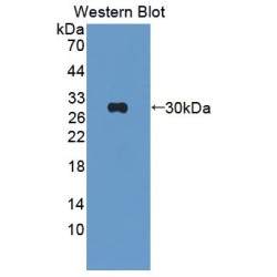 Mannose Binding Lectin (MBL) Antibody