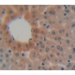 Mannose Binding Lectin (MBL) Antibody