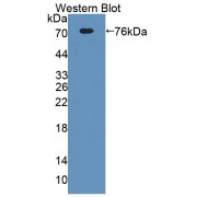 Western blot analysis of recombinant Mouse ECM1.