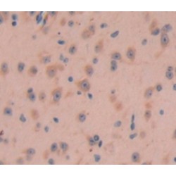 Myotubularin Related Protein 9 (MTMR9) Antibody