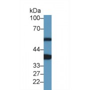 Western blot analysis of Rat Heart lysate, using Mouse ANKRD1 Antibody (1 µg/ml) and HRP-conjugated Goat Anti-Rabbit antibody (<a href="https://www.abbexa.com/index.php?route=product/search&amp;search=abx400043" target="_blank">abx400043</a>, 0.2 µg/ml).