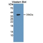 Western blot analysis of recombinant Mouse GLS2 protein.