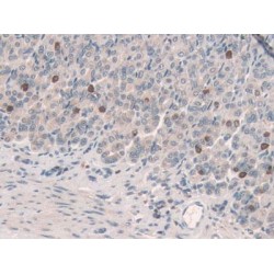 Secretagogin (SCGN) Antibody