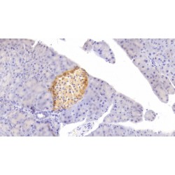 Fibroblast Growth Factor 21 (FGF21) Antibody