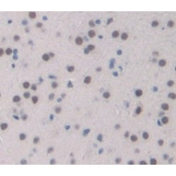 Tryptophan Hydroxylase 2 (TPH2) Antibody