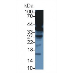 Alpha-Tocopherol Transfer Protein (TTPA) Antibody