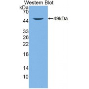 Western blot analysis of recombinant Mouse TTPa.