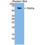 Western blot analysis of recombinant Mouse ITK.