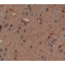 Acetyl Coenzyme A Acetyltransferase 2 (ACAT2) Antibody