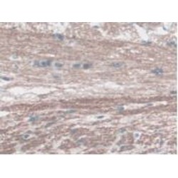 Glucagon Like Peptide 1 Receptor (GLP1R) Antibody
