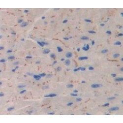 Calcium Channel, Voltage Dependent, L-Type, Alpha 1S Subunit (CACNa1S) Antibody