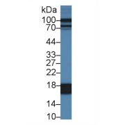 Western blot analysis of Pig Liver lysate, using Pig FABP1 Antibody (1 µg/ml) and HRP-conjugated Goat Anti-Rabbit antibody (<a href="https://www.abbexa.com/index.php?route=product/search&amp;search=abx400043" target="_blank">abx400043</a>, 0.2 µg/ml).